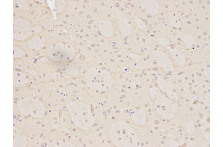 Immunohistochemistry - MNAT1 Antibody from Signalway Antibody (32496) - Antibodies.com