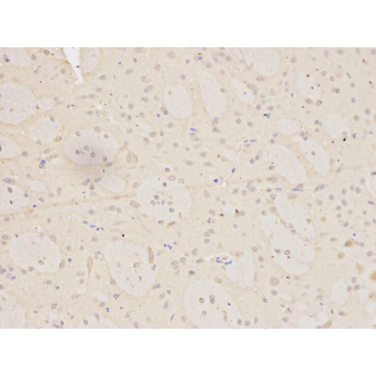 Immunohistochemistry - MNAT1 Antibody from Signalway Antibody (32496) - Antibodies.com