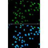 Immunofluorescence - MNAT1 Antibody from Signalway Antibody (32496) - Antibodies.com