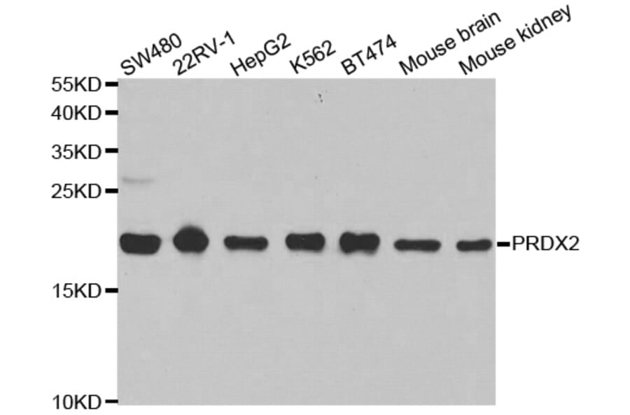 Western blot - PRDX2 Antibody from Signalway Antibody (32497) - Antibodies.com