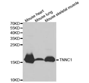 Western blot - TNNC1 Antibody from Signalway Antibody (32502) - Antibodies.com