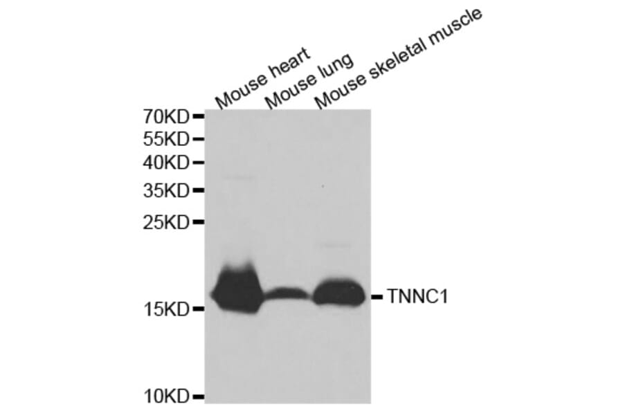 Western blot - TNNC1 Antibody from Signalway Antibody (32502) - Antibodies.com