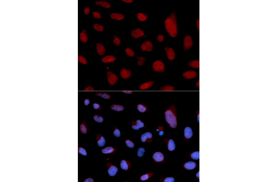 Immunofluorescence - TNNC1 Antibody from Signalway Antibody (32502) - Antibodies.com