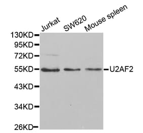 Western blot - U2AF2 Antibody from Signalway Antibody (32508) - Antibodies.com