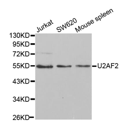 Western blot - U2AF2 Antibody from Signalway Antibody (32508) - Antibodies.com