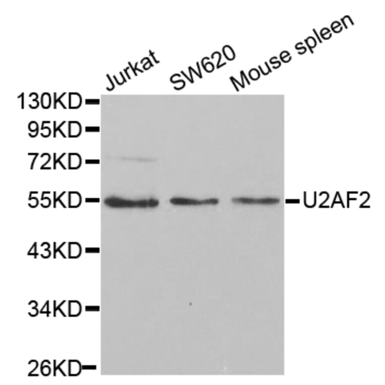 Western blot - U2AF2 Antibody from Signalway Antibody (32508) - Antibodies.com