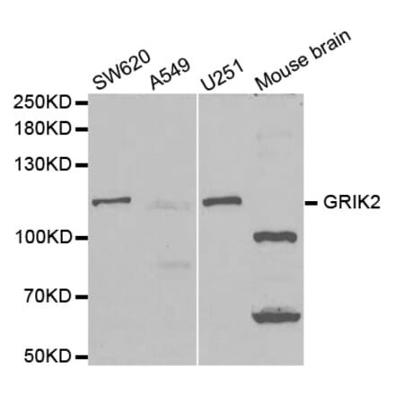 Western blot - GRIK2 Antibody from Signalway Antibody (32509) - Antibodies.com