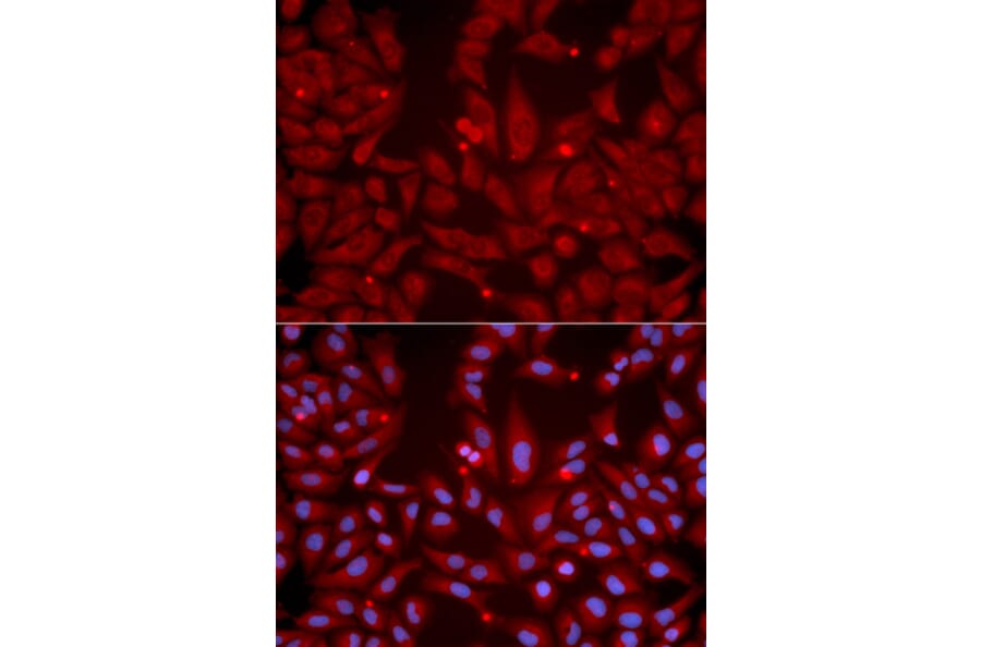 Immunofluorescence - GRIK2 Antibody from Signalway Antibody (32509) - Antibodies.com