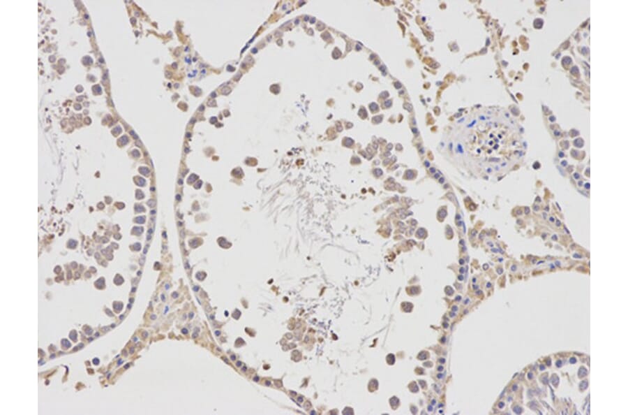 Immunohistochemistry - APBB1 Antibody from Signalway Antibody (32511) - Antibodies.com
