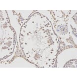 Immunohistochemistry - APBB1 Antibody from Signalway Antibody (32511) - Antibodies.com