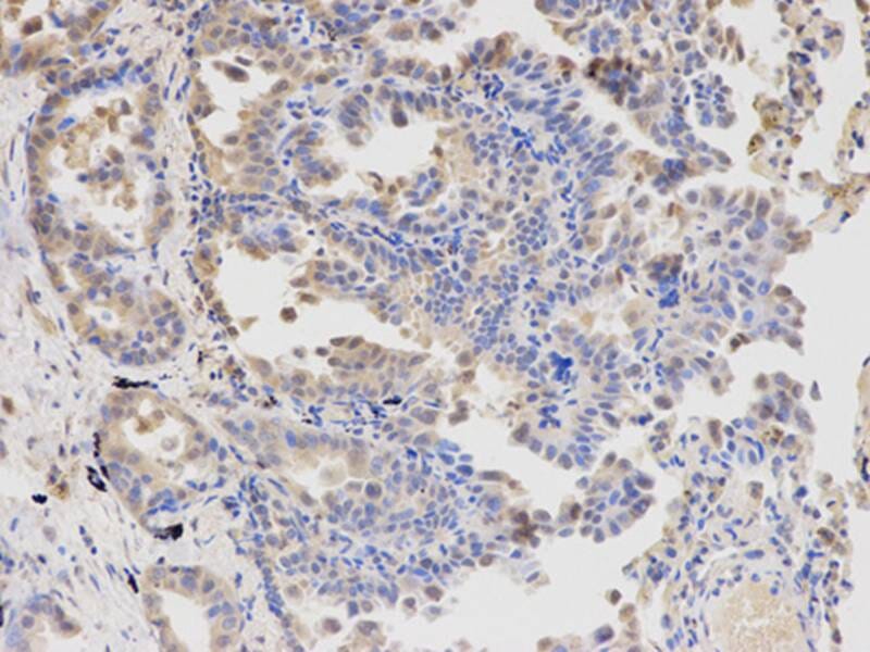 Immunohistochemical analysis of paraffin-embedded rat lung using APBB1 antibody at dilution of 1: 100 (200x lens).