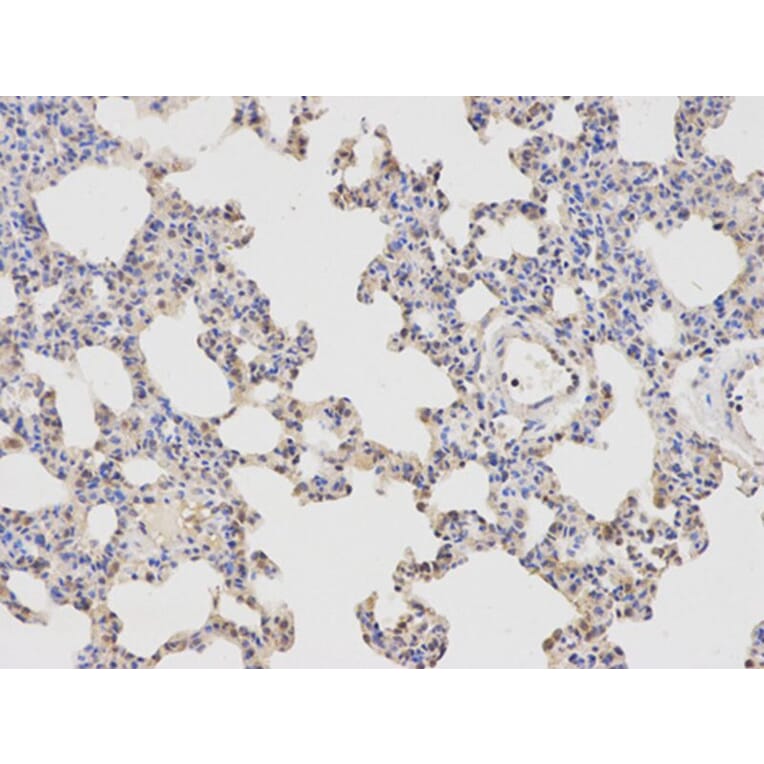 Immunohistochemistry - APBB1 Antibody from Signalway Antibody (32511) - Antibodies.com