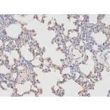 Immunohistochemistry - APBB1 Antibody from Signalway Antibody (32511) - Antibodies.com