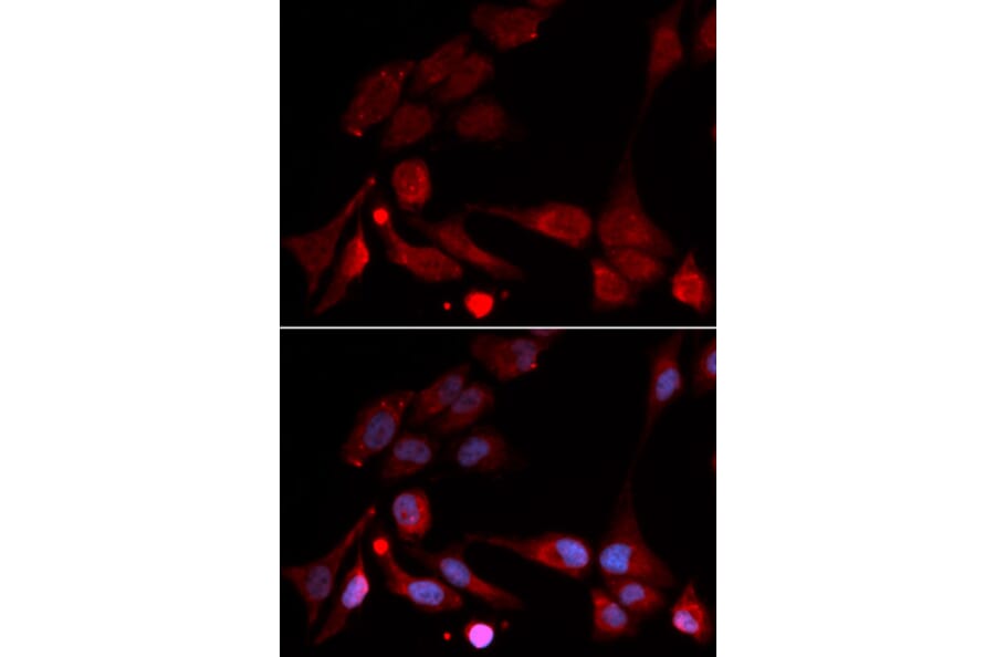 Immunofluorescence - APBB1 Antibody from Signalway Antibody (32511) - Antibodies.com