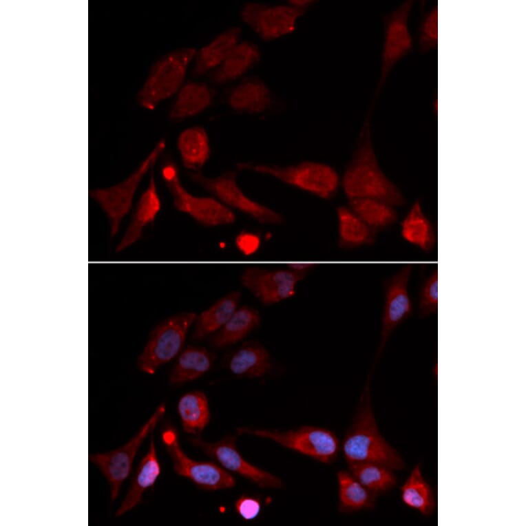 Immunofluorescence - APBB1 Antibody from Signalway Antibody (32511) - Antibodies.com