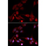 Immunofluorescence - APBB1 Antibody from Signalway Antibody (32511) - Antibodies.com
