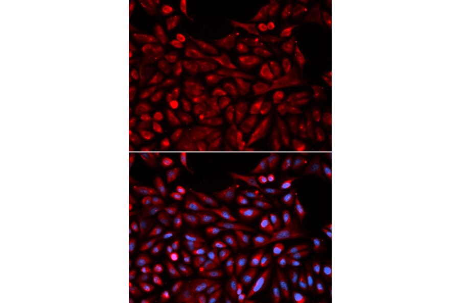 Anti-NR1I3 Antibody (A35207) | Antibodies.com