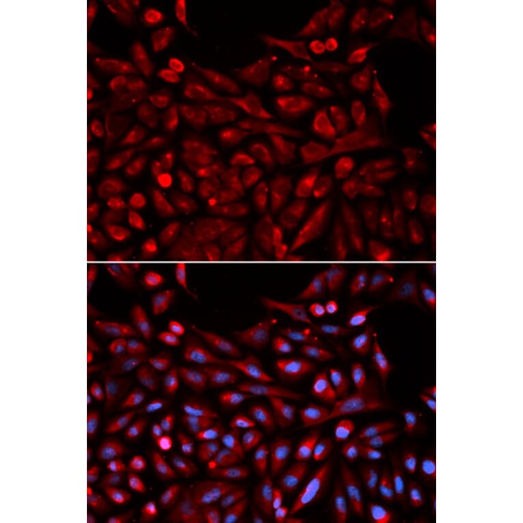 Immunofluorescence - NR1I3 Antibody from Signalway Antibody (32527) - Antibodies.com
