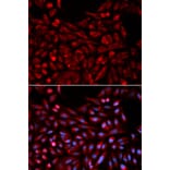 Immunofluorescence - NR1I3 Antibody from Signalway Antibody (32527) - Antibodies.com