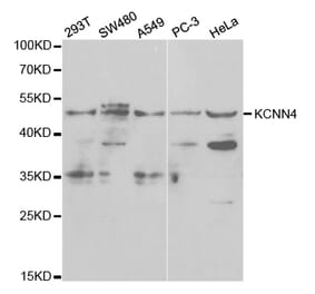 Western blot - KCNN4 Antibody from Signalway Antibody (32529) - Antibodies.com