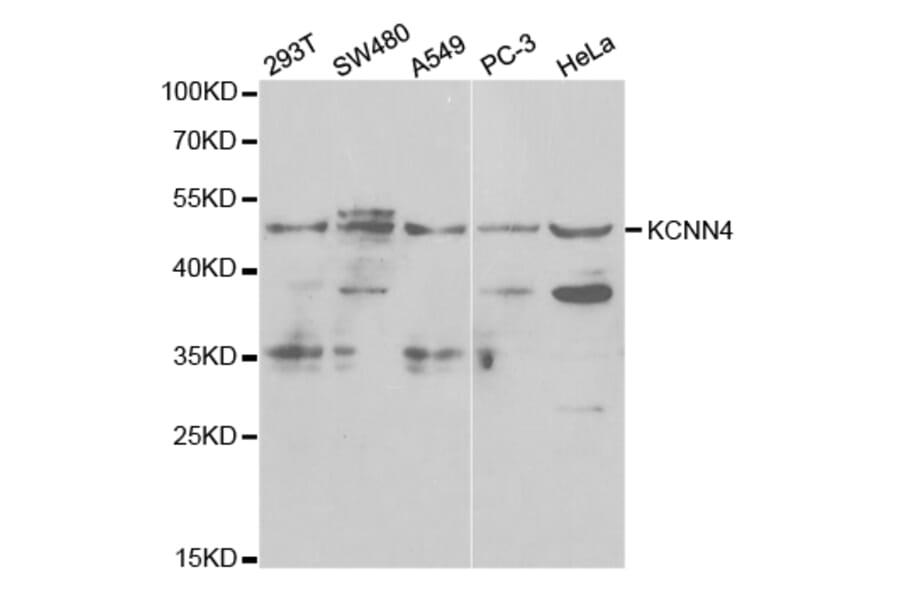 Western blot - KCNN4 Antibody from Signalway Antibody (32529) - Antibodies.com