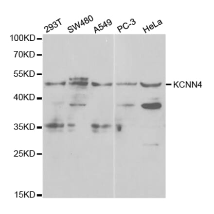 Western blot - KCNN4 Antibody from Signalway Antibody (32529) - Antibodies.com