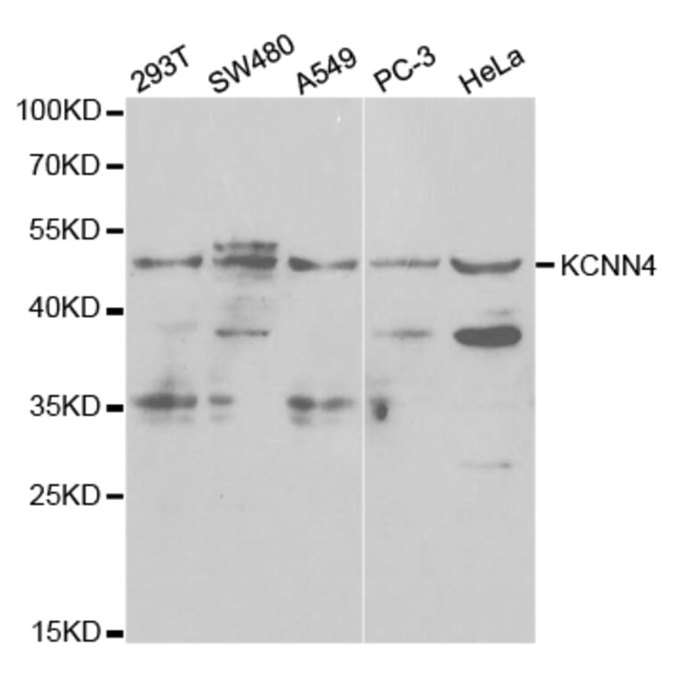 Western blot - KCNN4 Antibody from Signalway Antibody (32529) - Antibodies.com