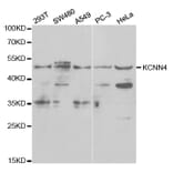 Western blot - KCNN4 Antibody from Signalway Antibody (32529) - Antibodies.com