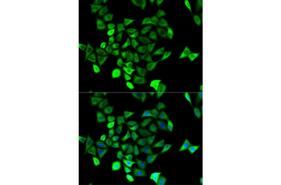 Immunofluorescence - KCNN4 Antibody from Signalway Antibody (32529) - Antibodies.com