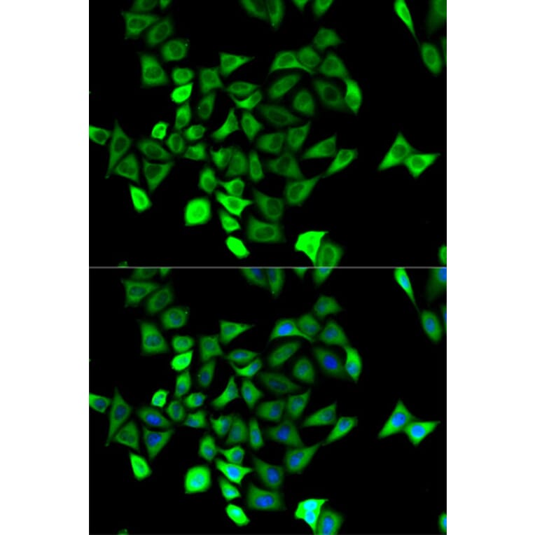 Immunofluorescence - KCNN4 Antibody from Signalway Antibody (32529) - Antibodies.com