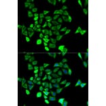 Immunofluorescence - KCNN4 Antibody from Signalway Antibody (32529) - Antibodies.com