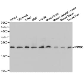 Western blot - PSMB5 Antibody from Signalway Antibody (32530) - Antibodies.com