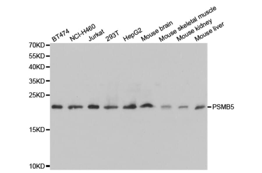 Western blot - PSMB5 Antibody from Signalway Antibody (32530) - Antibodies.com