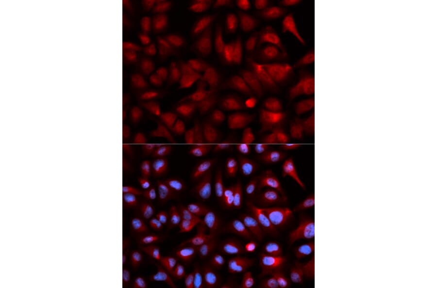 Immunofluorescence - PSMB5 Antibody from Signalway Antibody (32530) - Antibodies.com