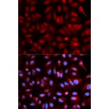 Immunofluorescence - PSMB5 Antibody from Signalway Antibody (32530) - Antibodies.com