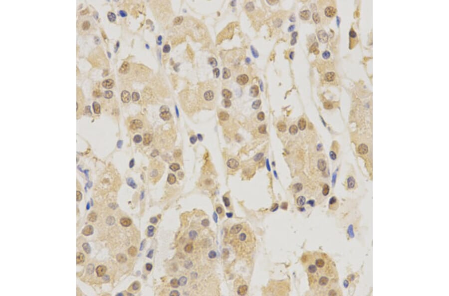 Immunohistochemistry - PSMB5 Antibody from Signalway Antibody (32530) - Antibodies.com