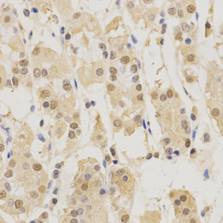 Immunohistochemistry - PSMB5 Antibody from Signalway Antibody (32530) - Antibodies.com