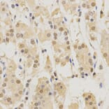 Immunohistochemistry - PSMB5 Antibody from Signalway Antibody (32530) - Antibodies.com