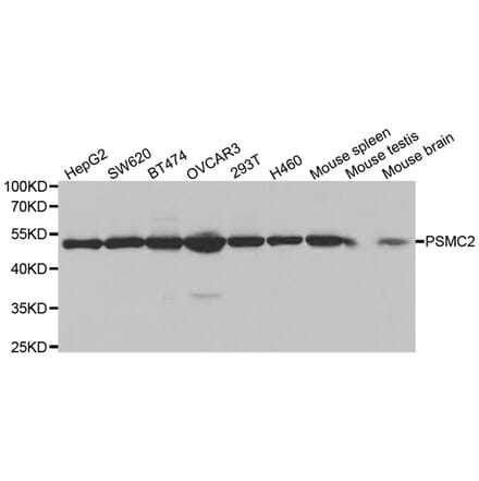 Western blot - PSMC2 Antibody from Signalway Antibody (32536) - Antibodies.com