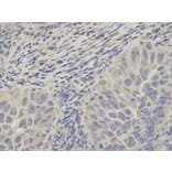 Immunohistochemistry - PSMC2 Antibody from Signalway Antibody (32536) - Antibodies.com