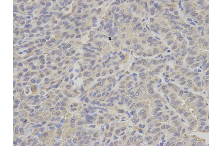 Immunohistochemistry - PSMC2 Antibody from Signalway Antibody (32536) - Antibodies.com