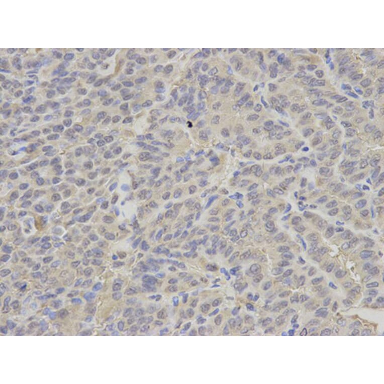 Immunohistochemistry - PSMC2 Antibody from Signalway Antibody (32536) - Antibodies.com