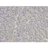 Immunohistochemistry - PSMC2 Antibody from Signalway Antibody (32536) - Antibodies.com