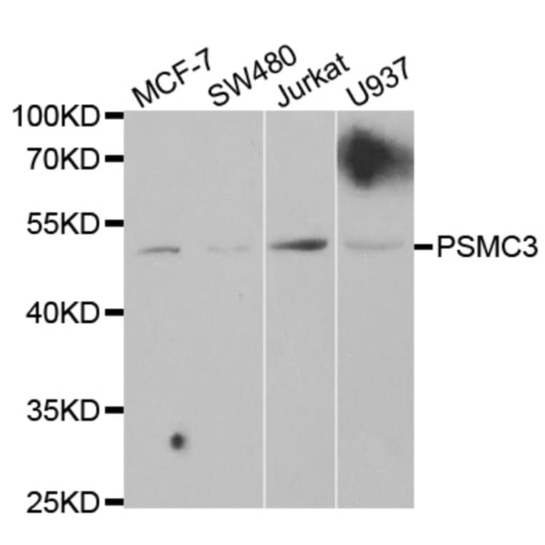 Western blot - PSMC3 Antibody from Signalway Antibody (32537) - Antibodies.com