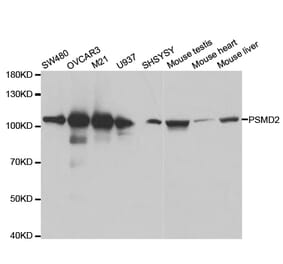 Western blot - PSMD2 Antibody from Signalway Antibody (32544) - Antibodies.com