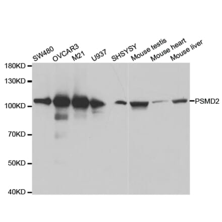 Western blot - PSMD2 Antibody from Signalway Antibody (32544) - Antibodies.com