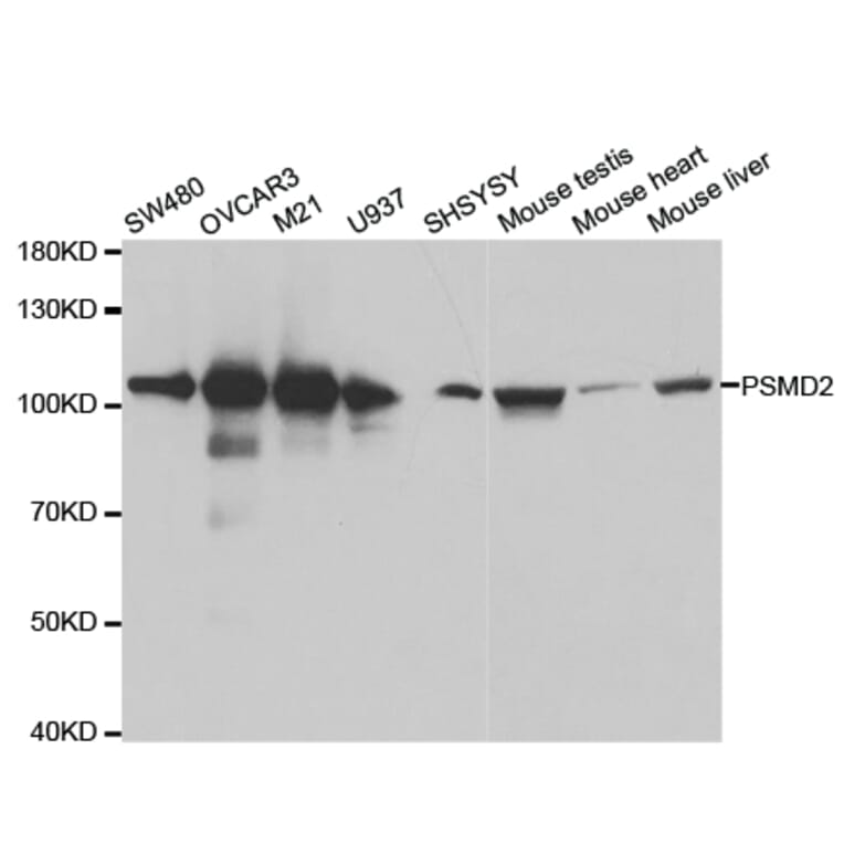 Western blot - PSMD2 Antibody from Signalway Antibody (32544) - Antibodies.com