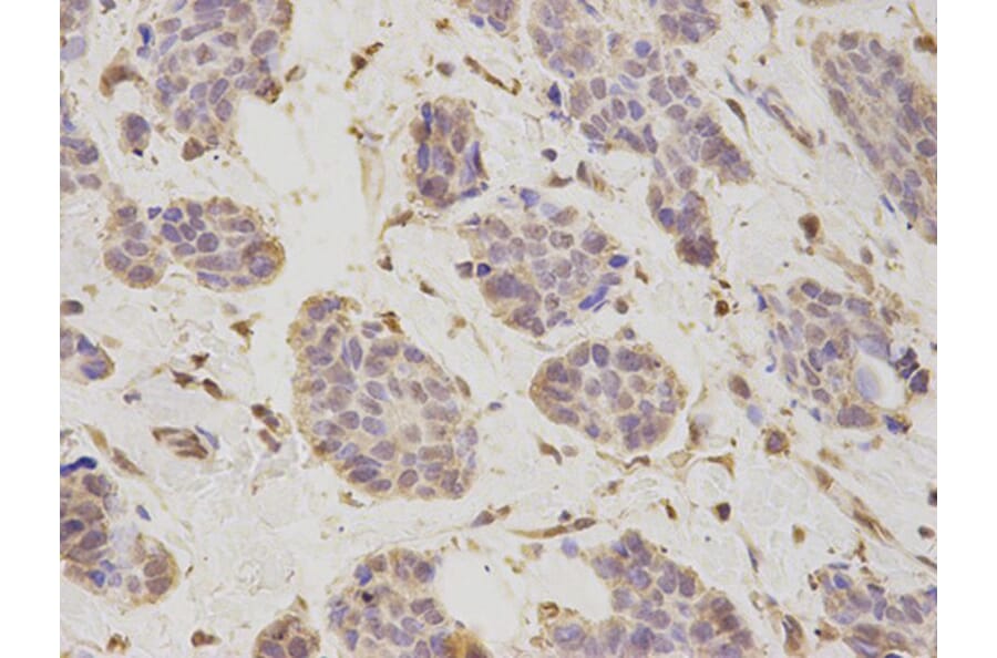 Immunohistochemistry - PSMD2 Antibody from Signalway Antibody (32544) - Antibodies.com
