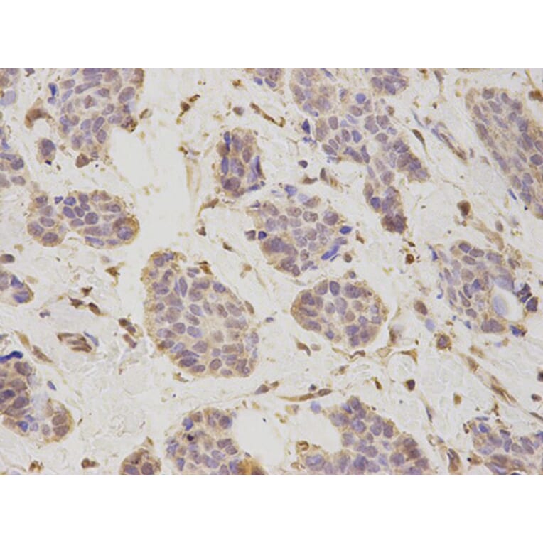 Immunohistochemistry - PSMD2 Antibody from Signalway Antibody (32544) - Antibodies.com