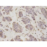 Immunohistochemistry - PSMD2 Antibody from Signalway Antibody (32544) - Antibodies.com